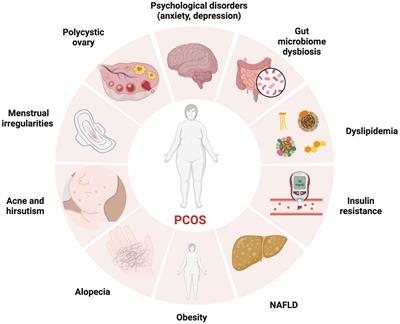 Signaling pathways and targeted therapeutic strategies for polycystic ovary syndrome